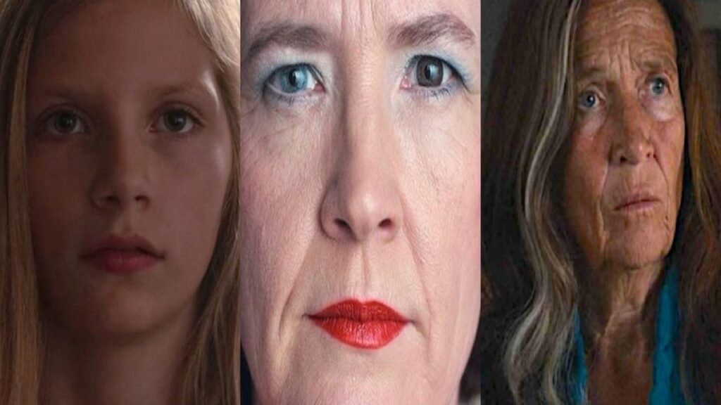 Síndrome de Waardenburg en 'Dark'