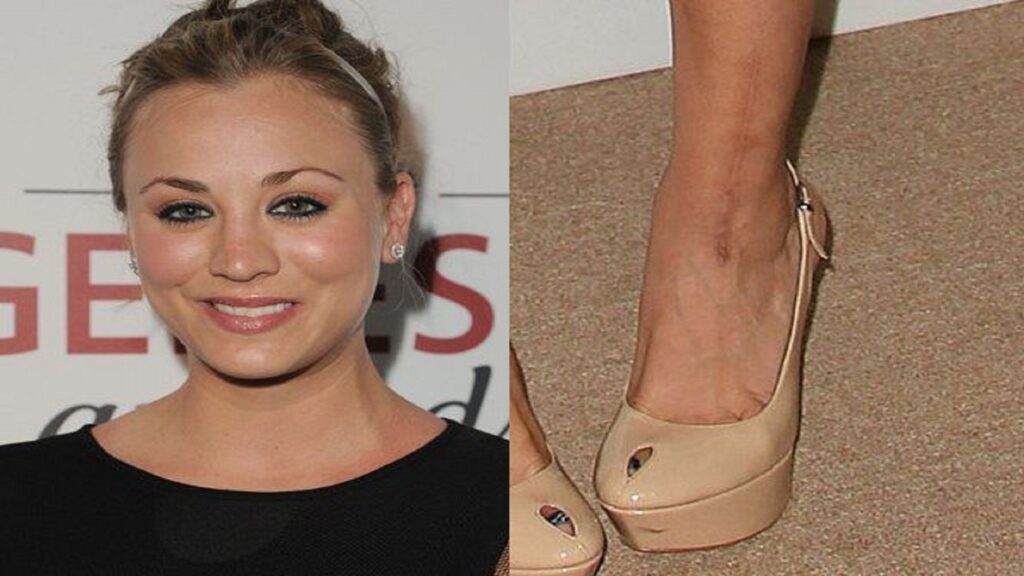 Accidente de Kaley Cuoco